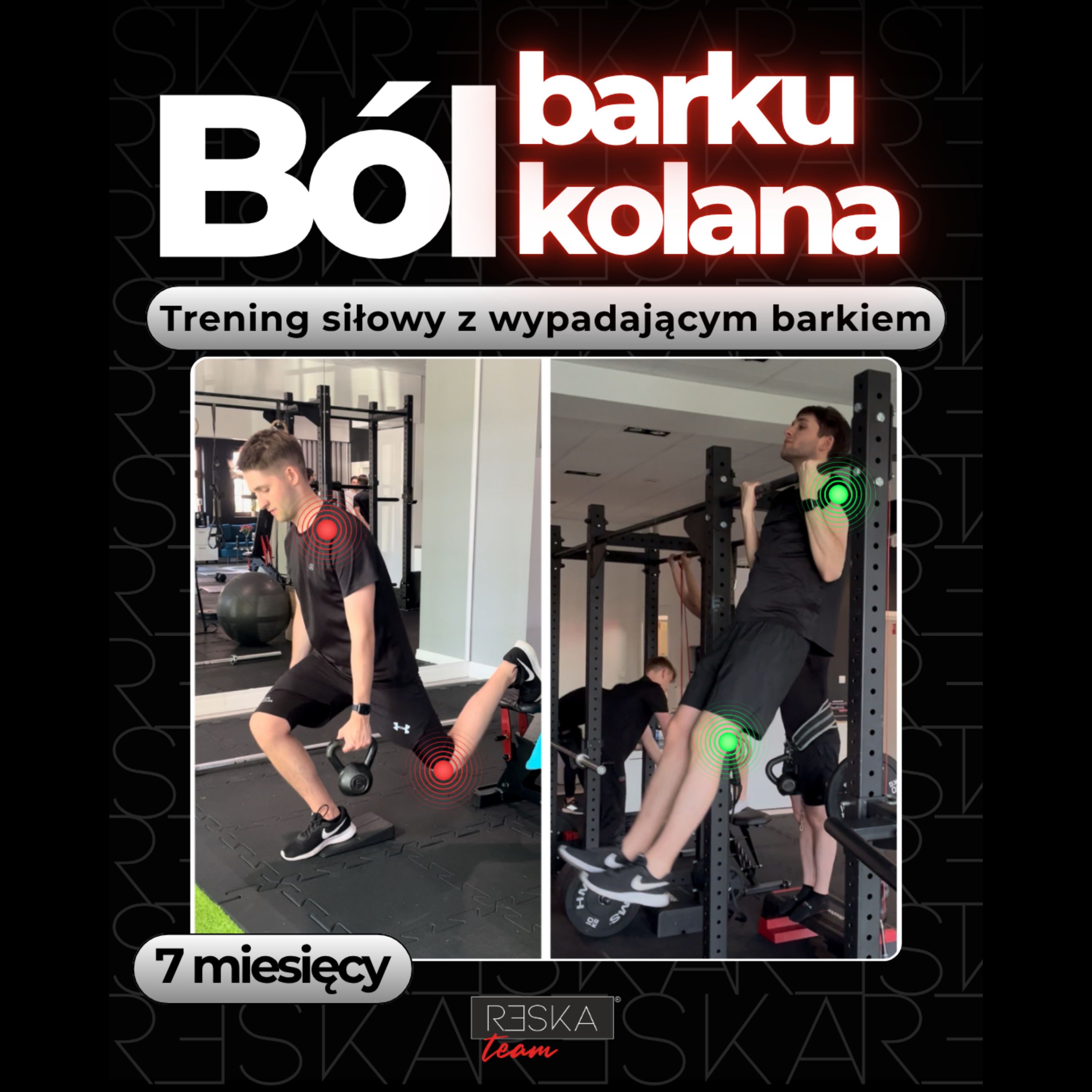 Jak pozbyć się bólu barku?