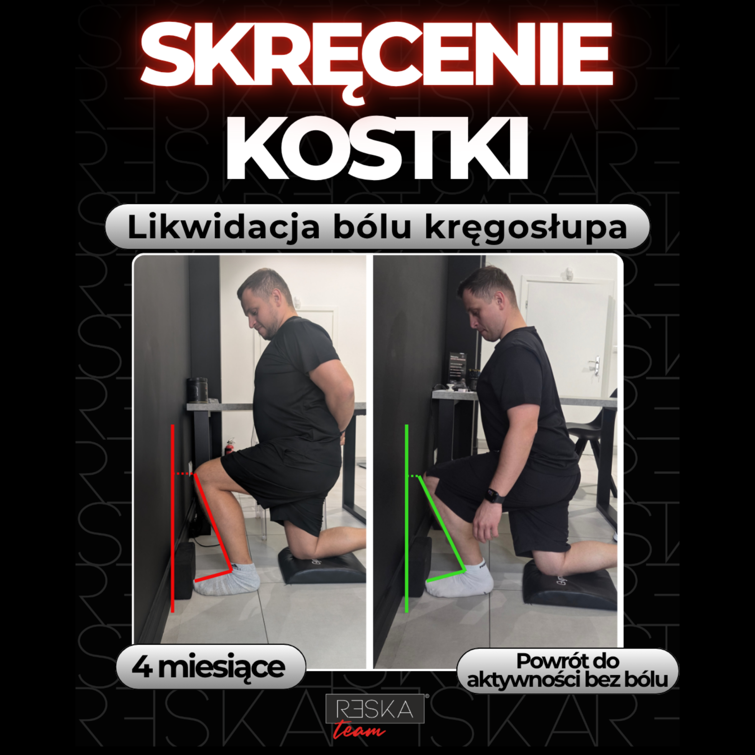 Rehabilitacja Wrocław – Maciek podczas ćwiczeń po skręceniu stawu skokowego w RESKAteam