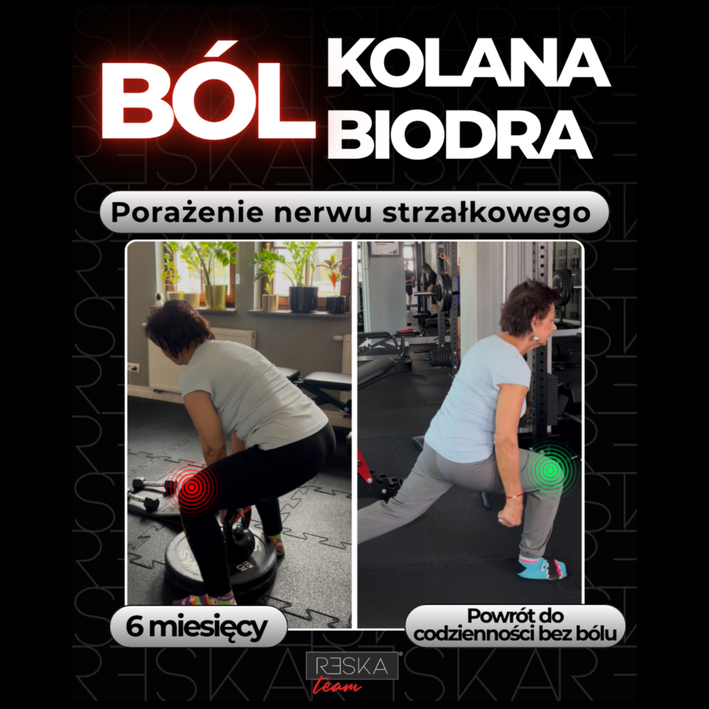 Ból kolana przy chodzeniu Wrocław - trening medyczny Beaty w RESKAteam